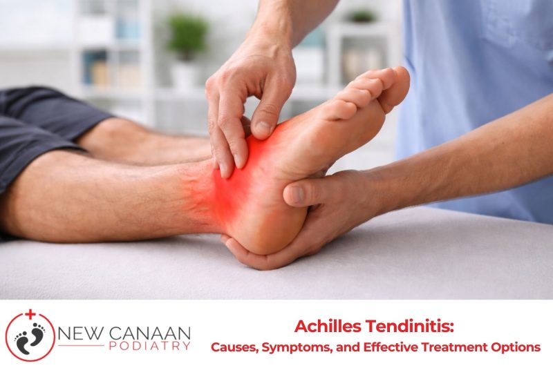 Achilles Tendinitis Causes, Symptoms, and Effective Treatment Options