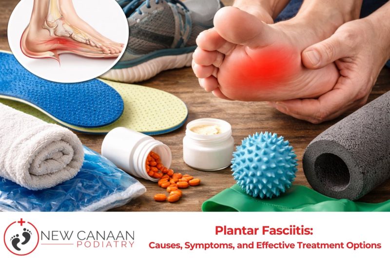 Plantar Fasciitis Causes, Symptoms, and Effective Treatment Options