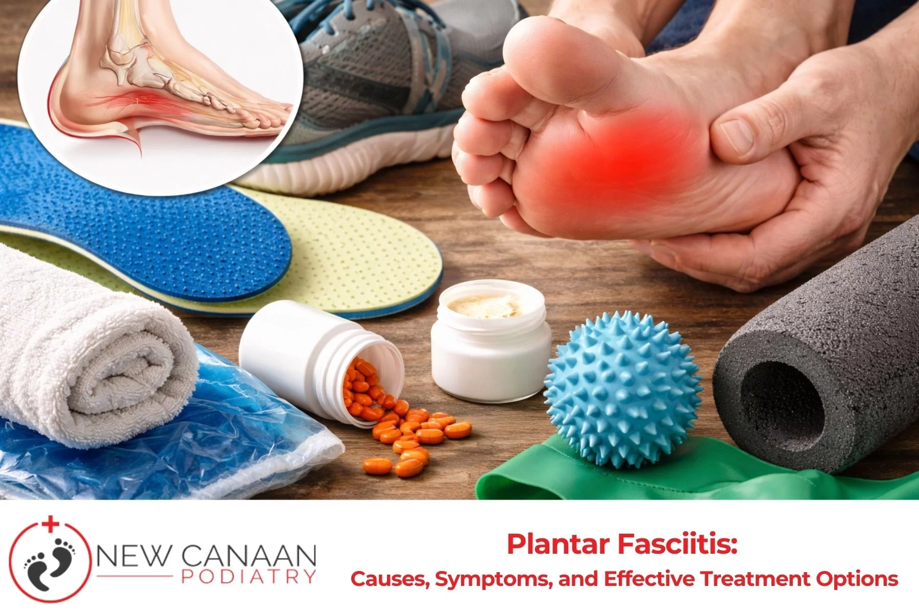 Plantar Fasciitis Causes, Symptoms, and Effective Treatment Options
