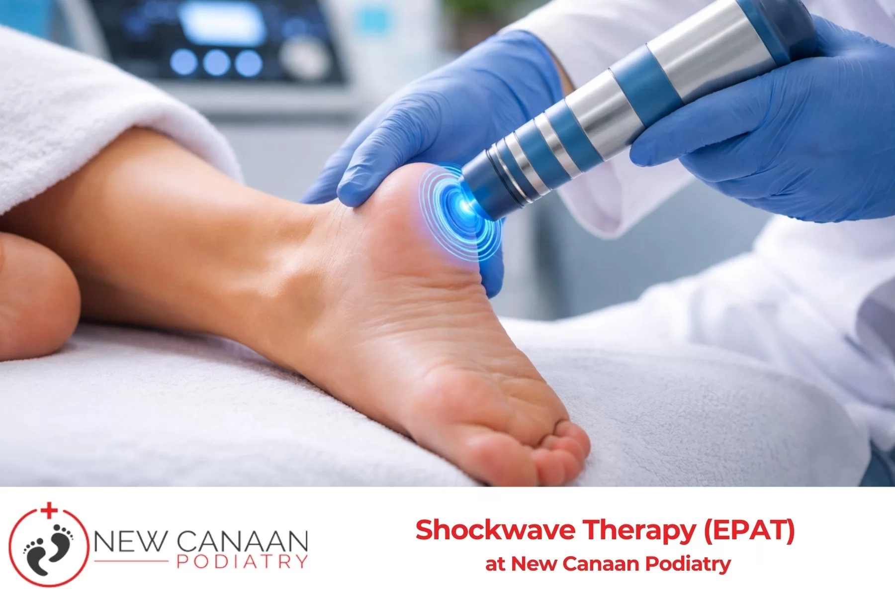 Shockwave Therapy EPAT at New Canaan Podiatry
